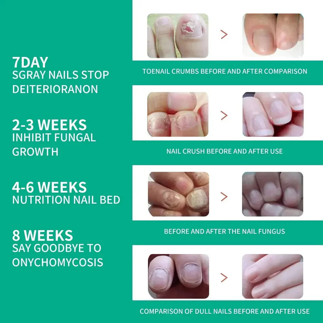 Nail Fungus Solution